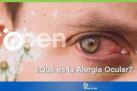 ¿Qué es la Alergia Ocular?
